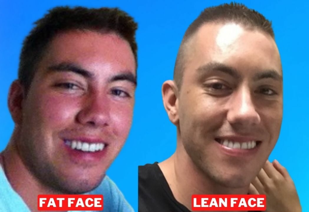 How to lose face fat in two days